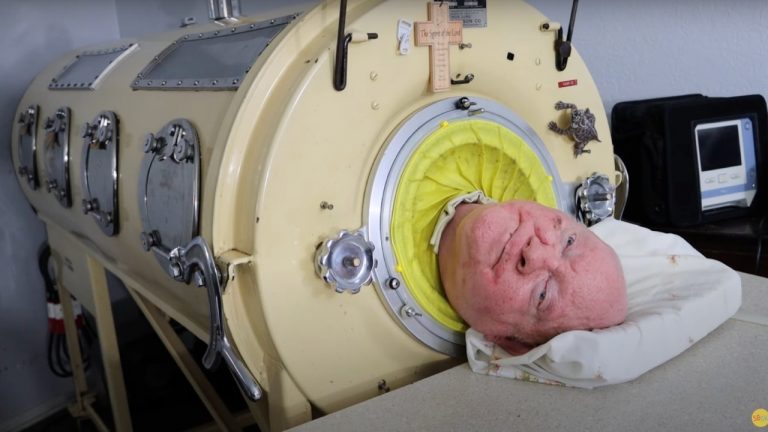 Paul Alexander spoke of God’s love despite 70 years in iron lung